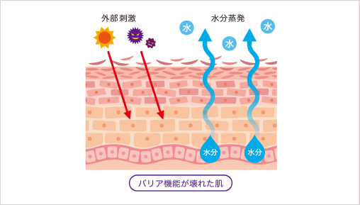 肌荒れの基本的な原因